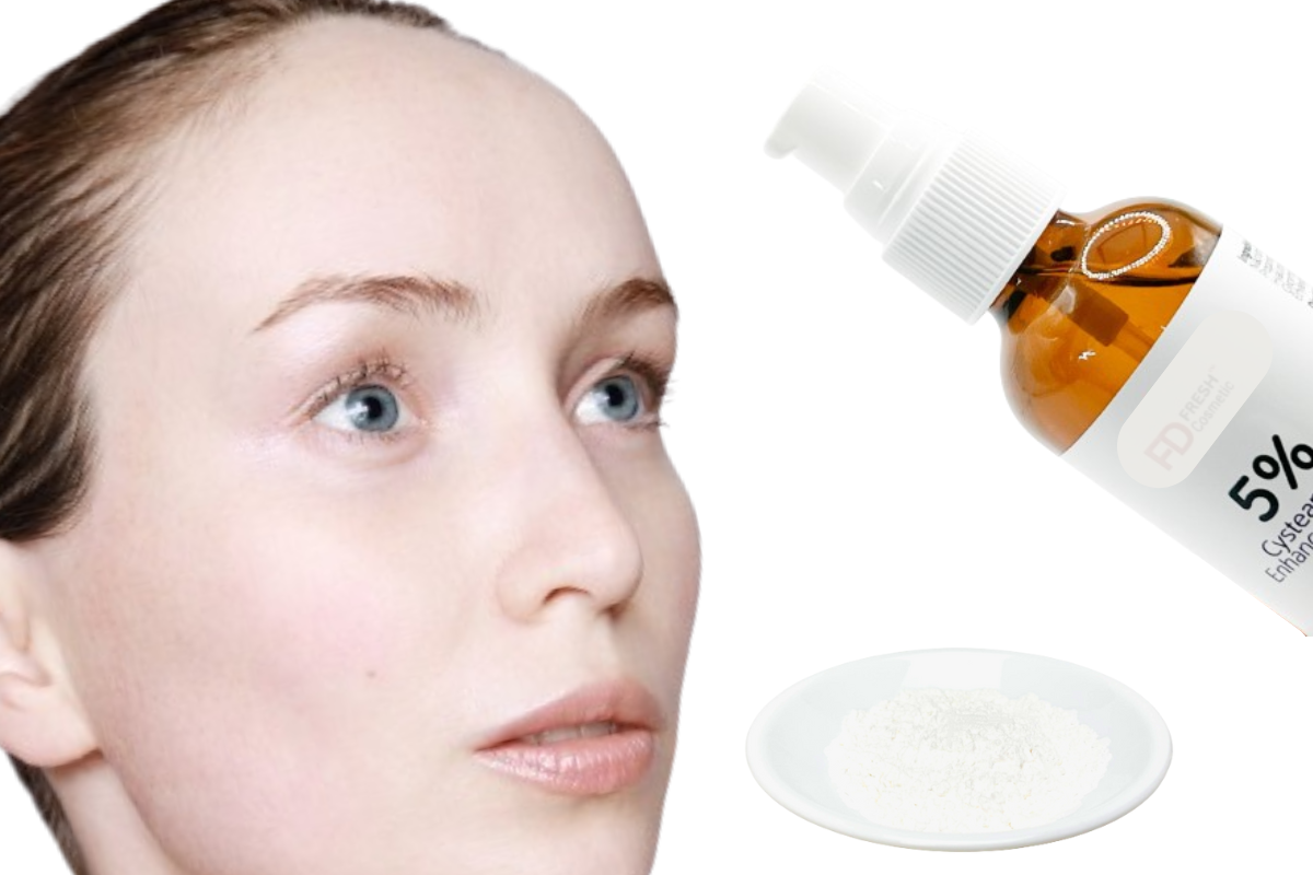 Cysteamine HCl - Everything You Need to Know About Cysteamine HCl ...